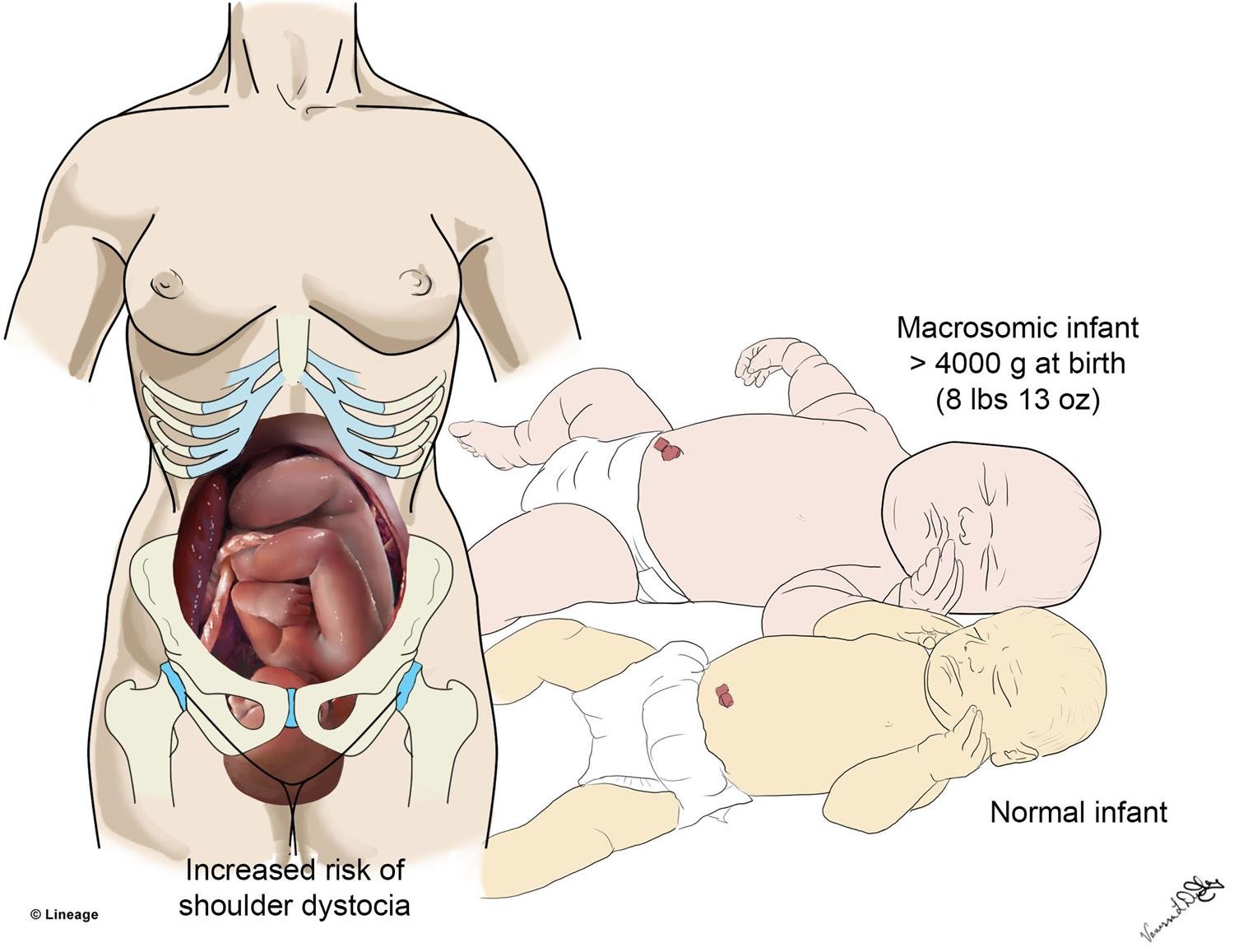 Abnormal obstetrics | Chapter 07 | Midwifery For Diploma In Nursing