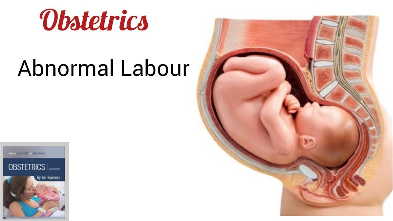 Abnormal obstetrics | Chapter 07 | Midwifery For Diploma In Nursing