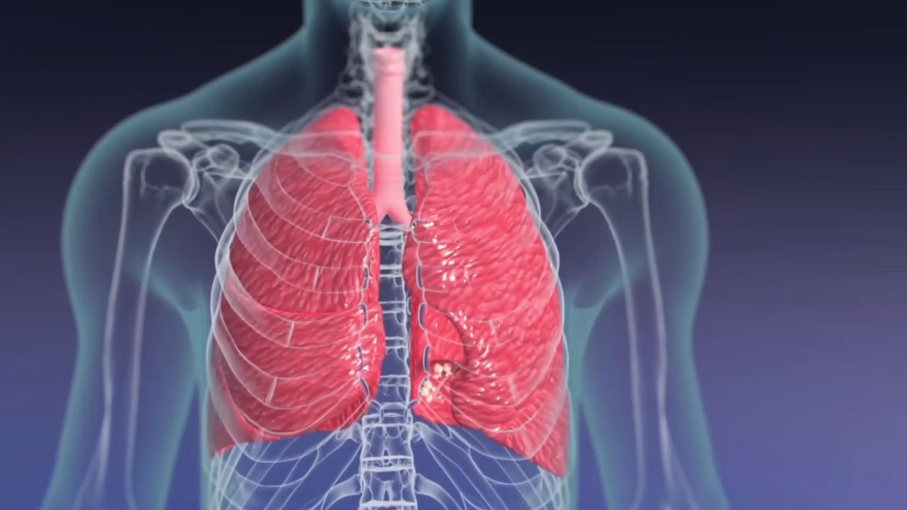 The lung | CHAPTER 4 | Anatomy and Physiology