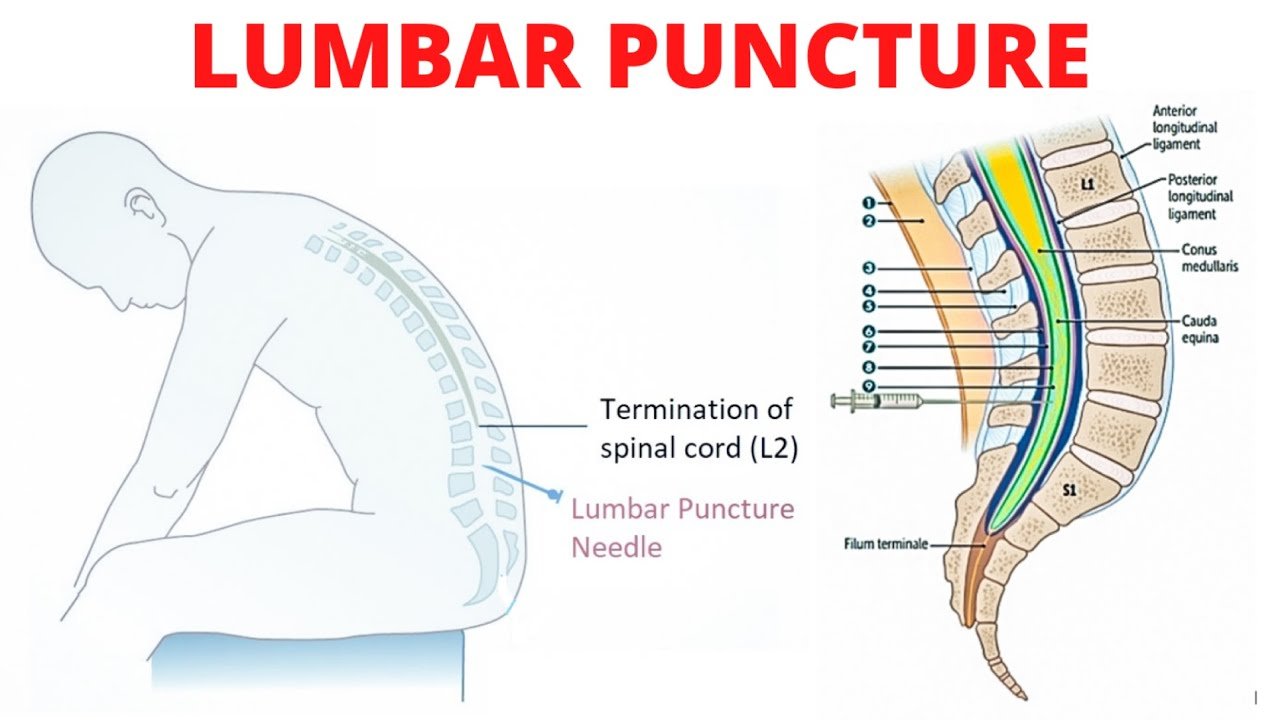 Concept about Lumber puncture | CHAPTER 7 | Anatomy and Physiology