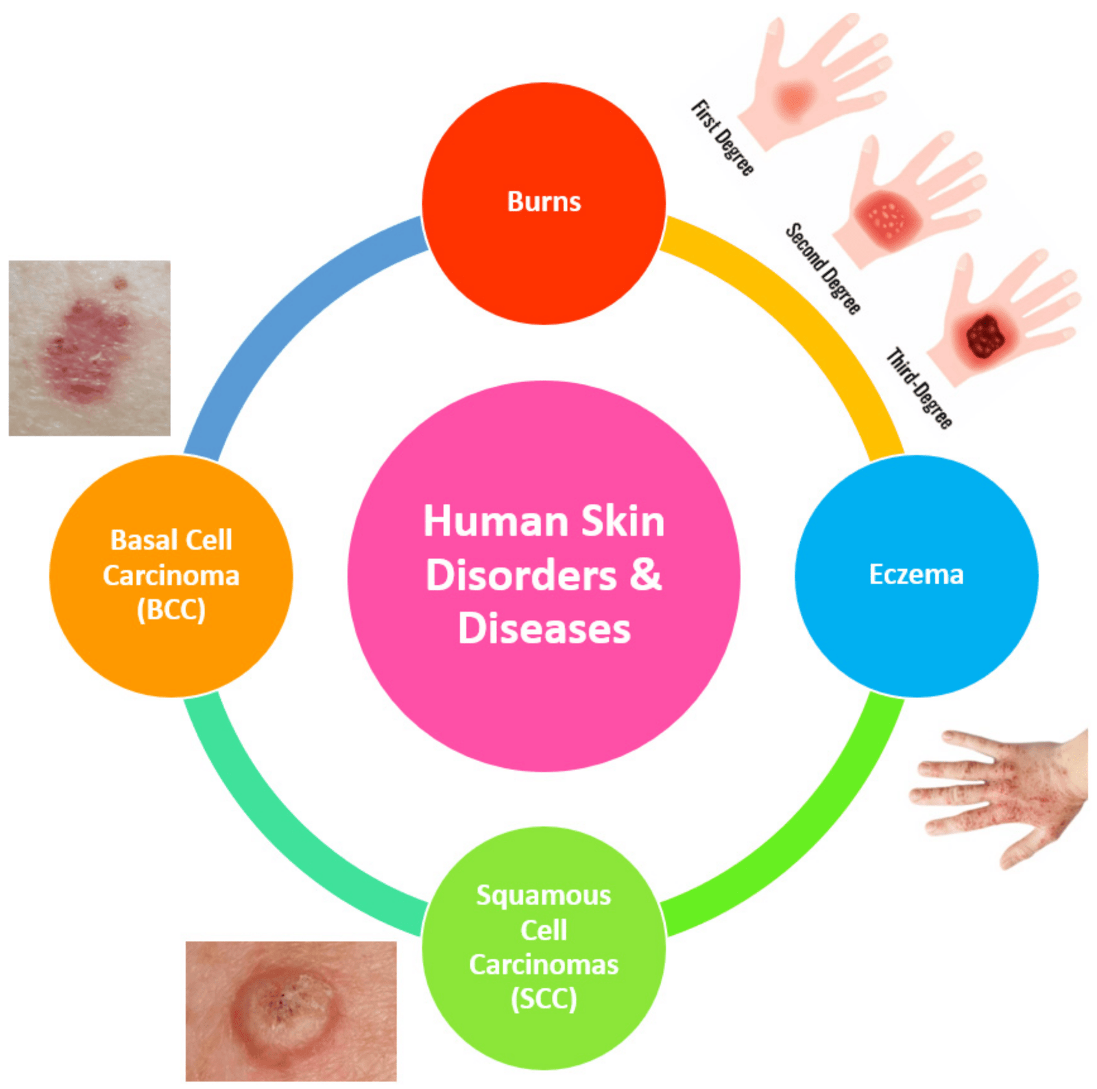 Common disorders and common terminology of integumentary system | CHAPTER 11 | Anatomy and Physiology