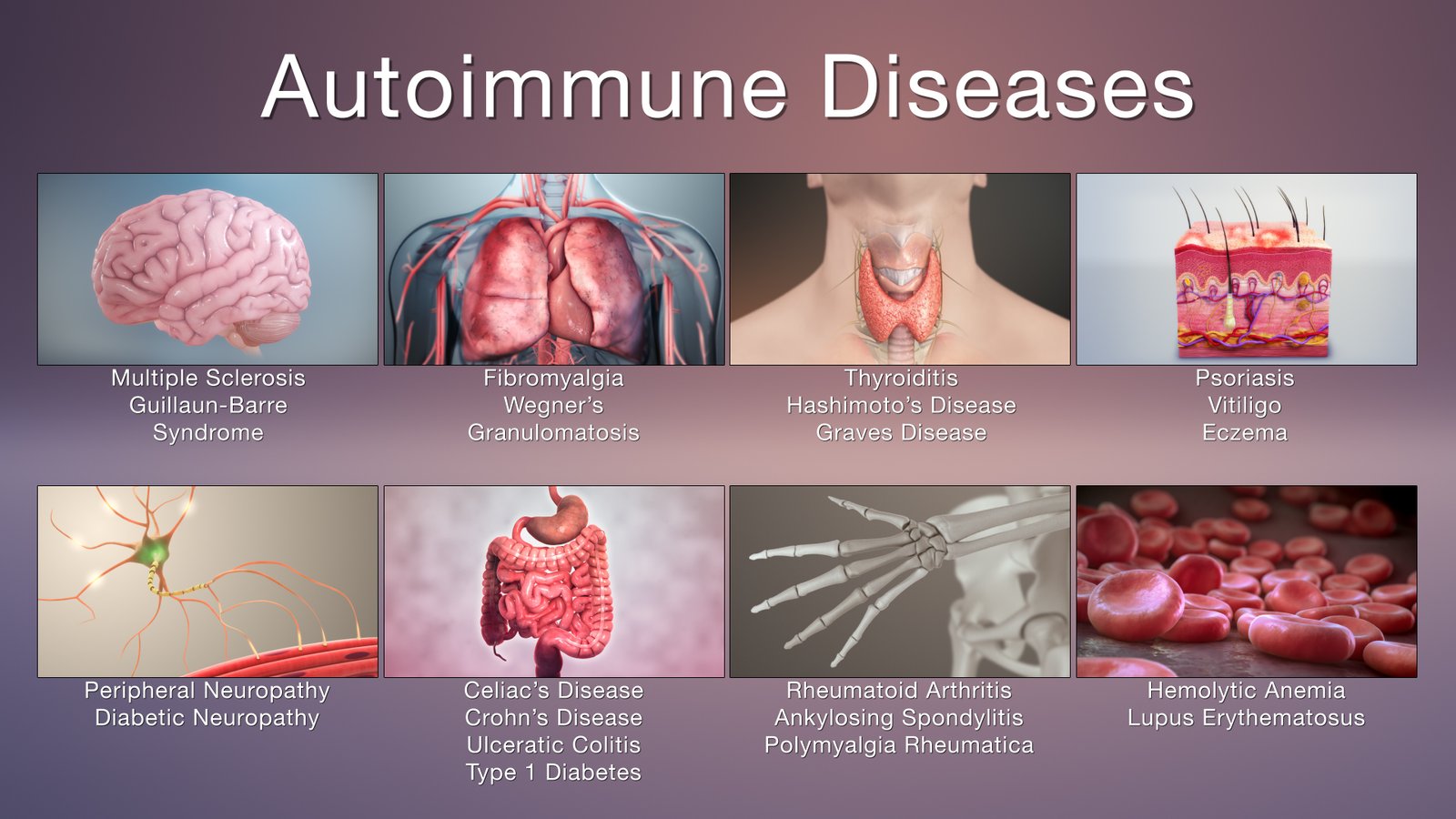 Autoimmune diseases | CHAPTER 12 | Anatomy and Physiology
