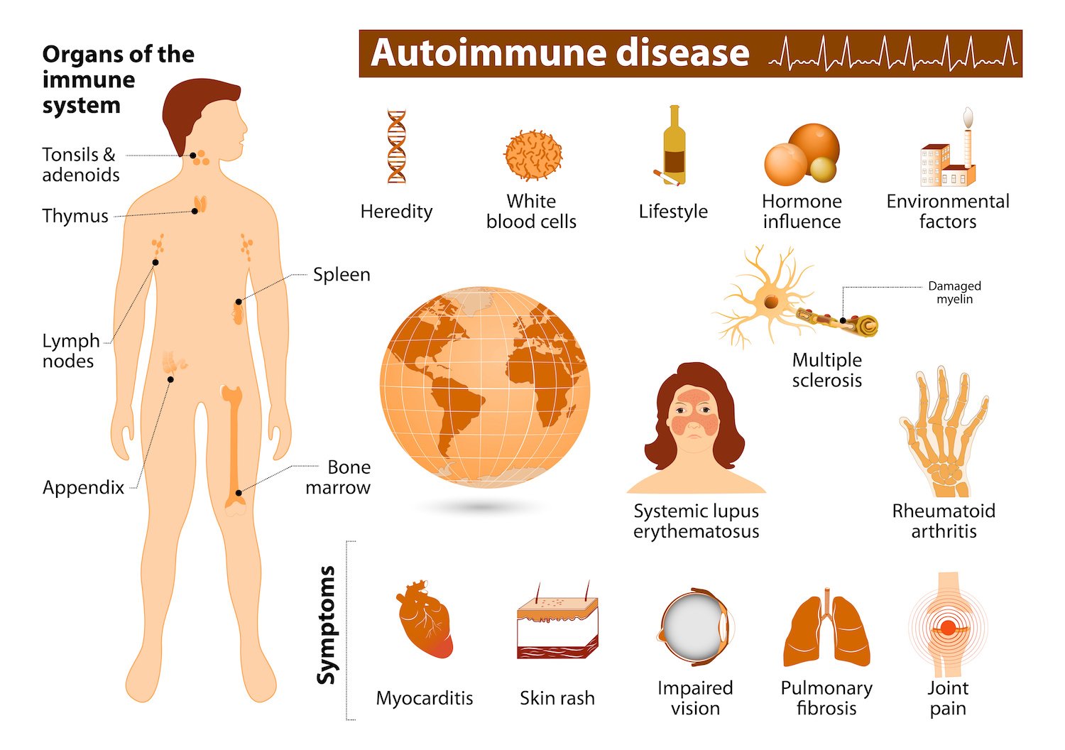 Autoimmune diseases | CHAPTER 12 | Anatomy and Physiology