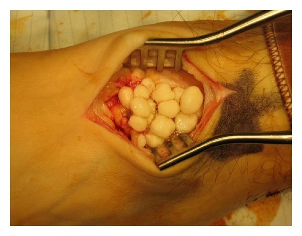 Important orthopedic terminology | CHAPTER 23 | Orthopedic Nursing