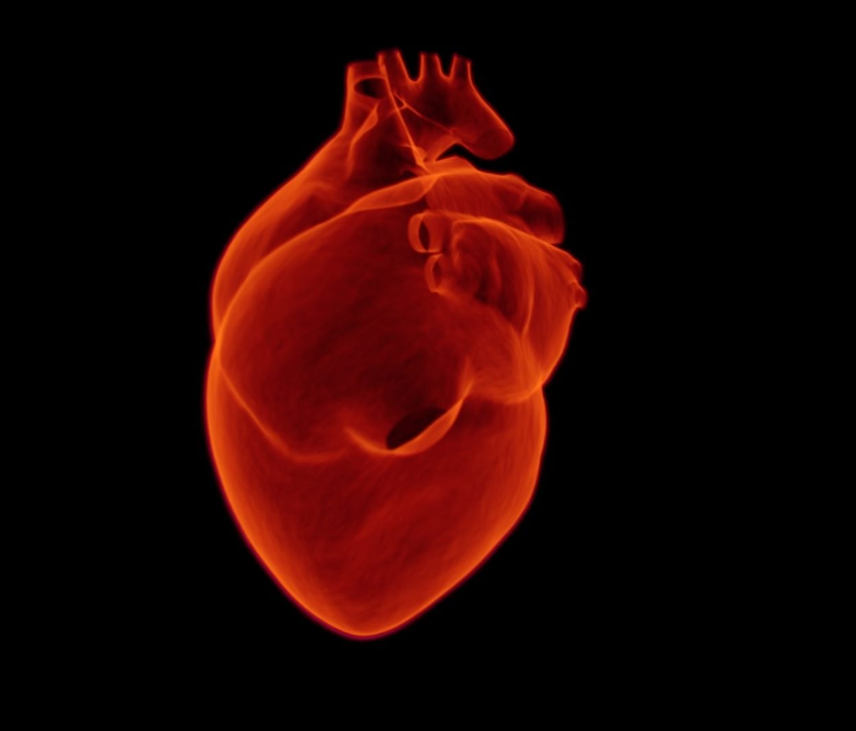 Congestive Heart Failure | CHAPTER 10 | Pediatric Nursing