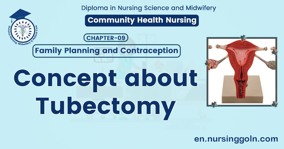 Concept about Tubectomy