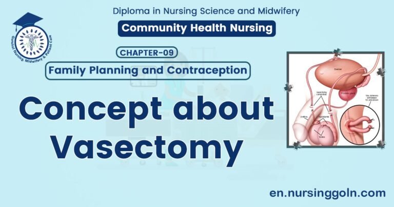 Concept about Vasectomy