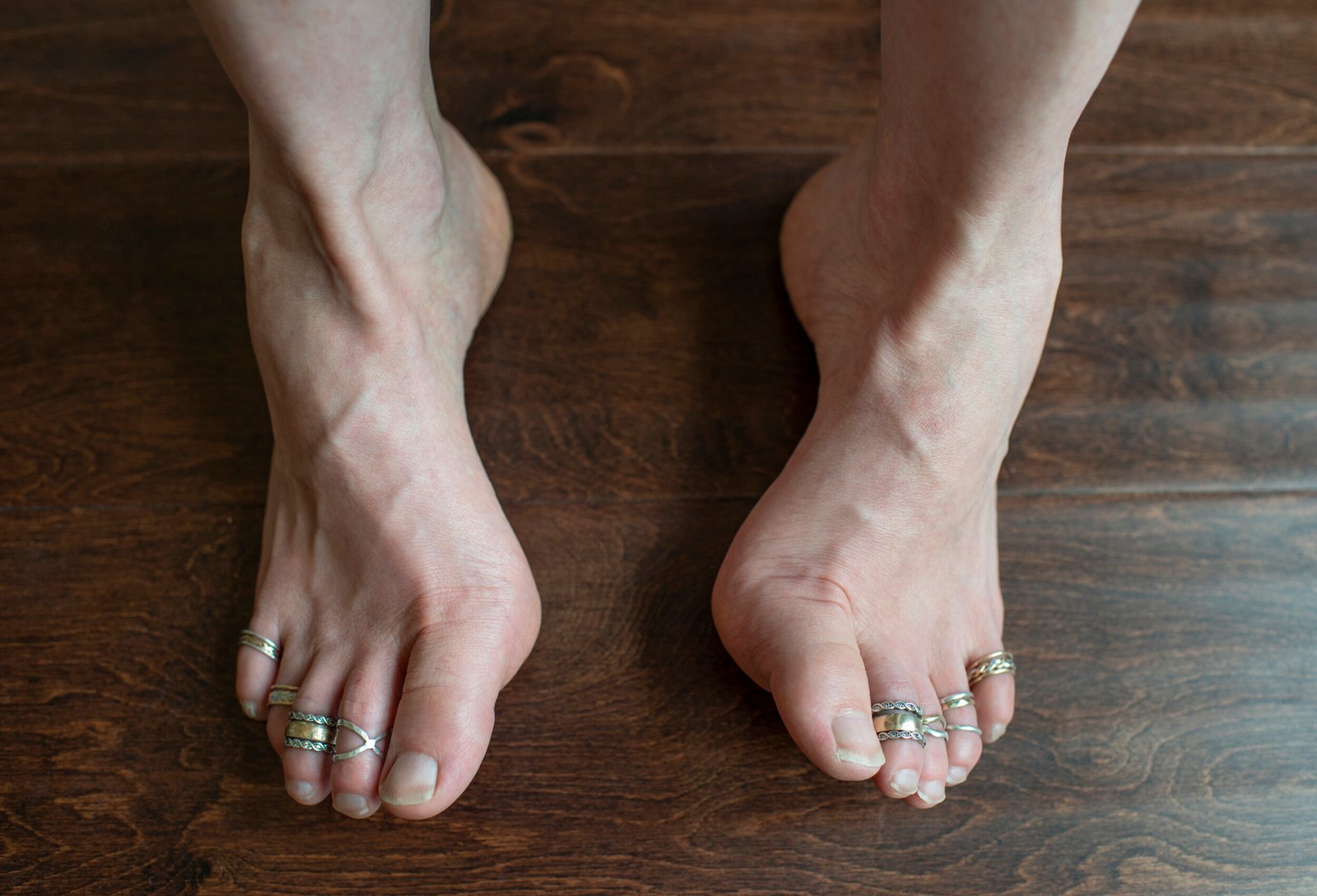 Important orthopedic terminology | CHAPTER 23 | Orthopedic Nursing