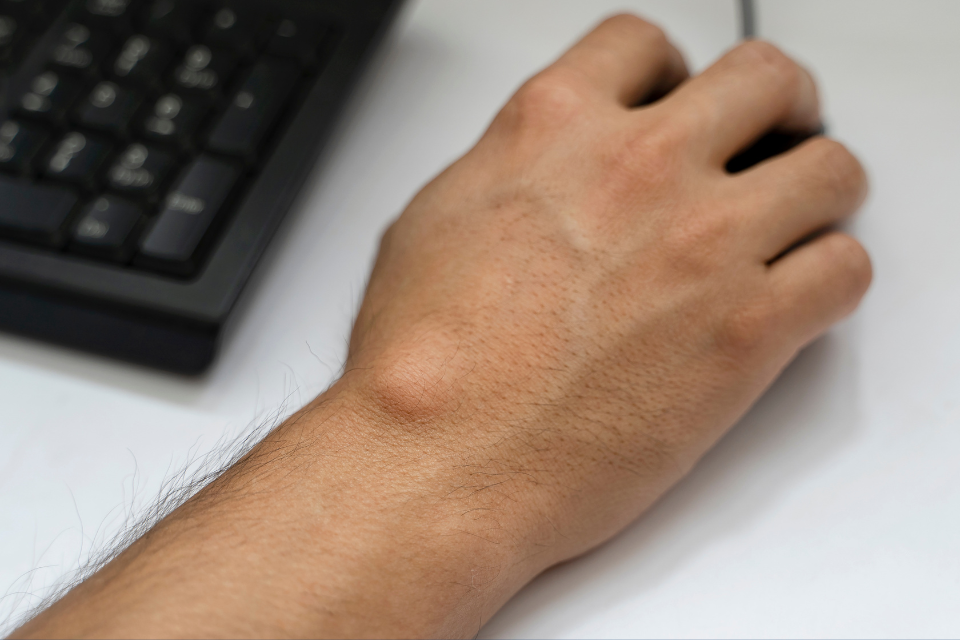 Important orthopedic terminology | CHAPTER 23 | Orthopedic Nursing