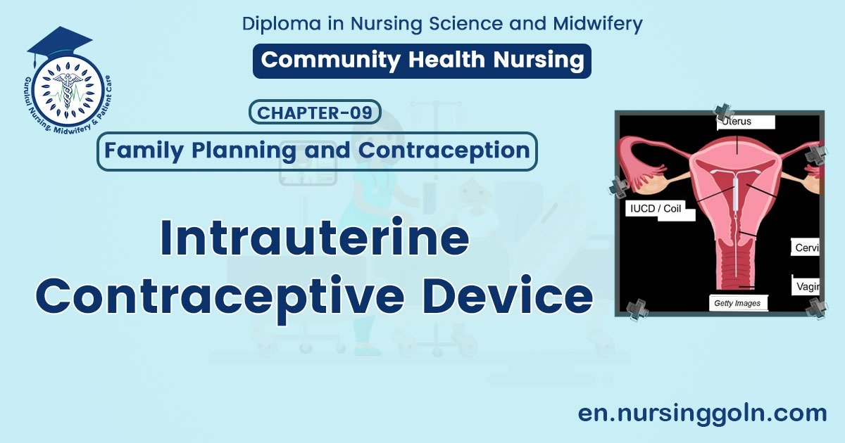 Intrauterine contraceptive device
