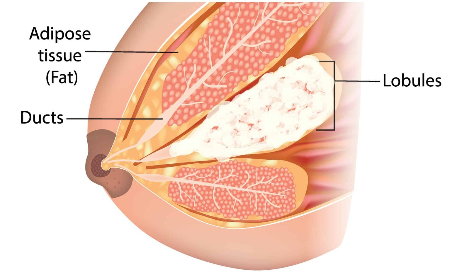 Concept about Mastitis