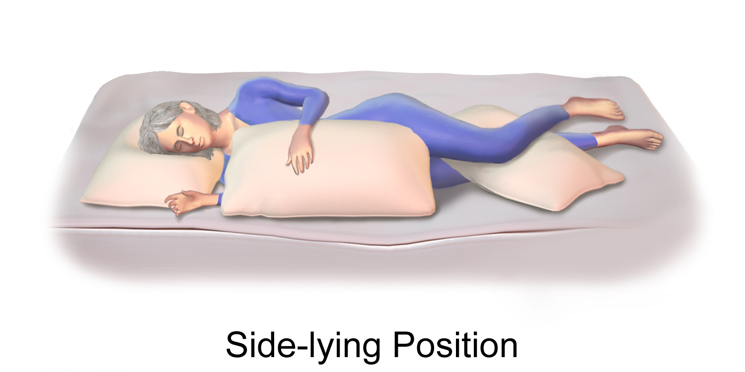 Concept About Positioning | CHAPTER 22 | Orthopedic Nursing