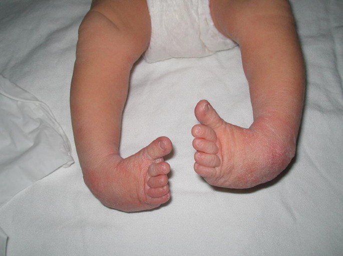 Important orthopedic terminology | CHAPTER 23 | Orthopedic Nursing