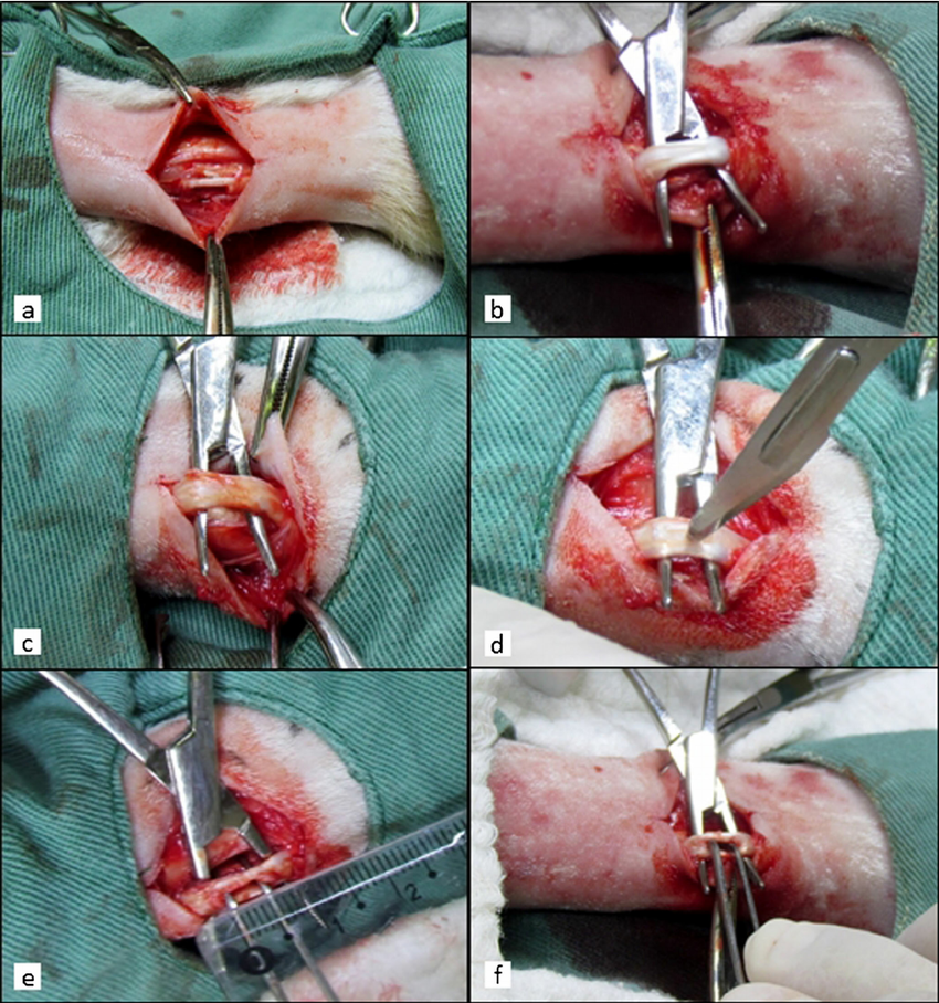 Important orthopedic terminology | CHAPTER 23 | Orthopedic Nursing
