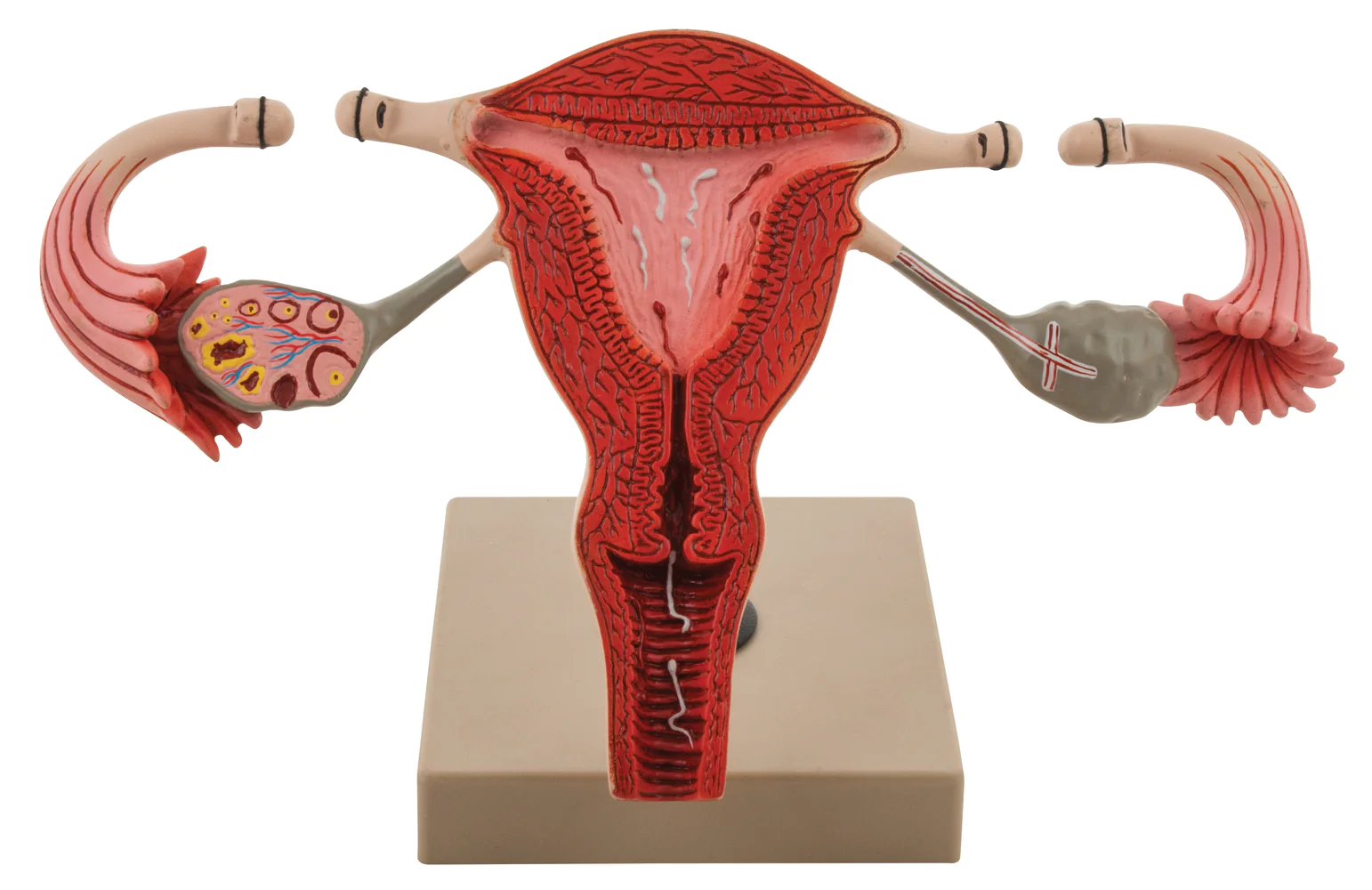 Concept about Tubectomy