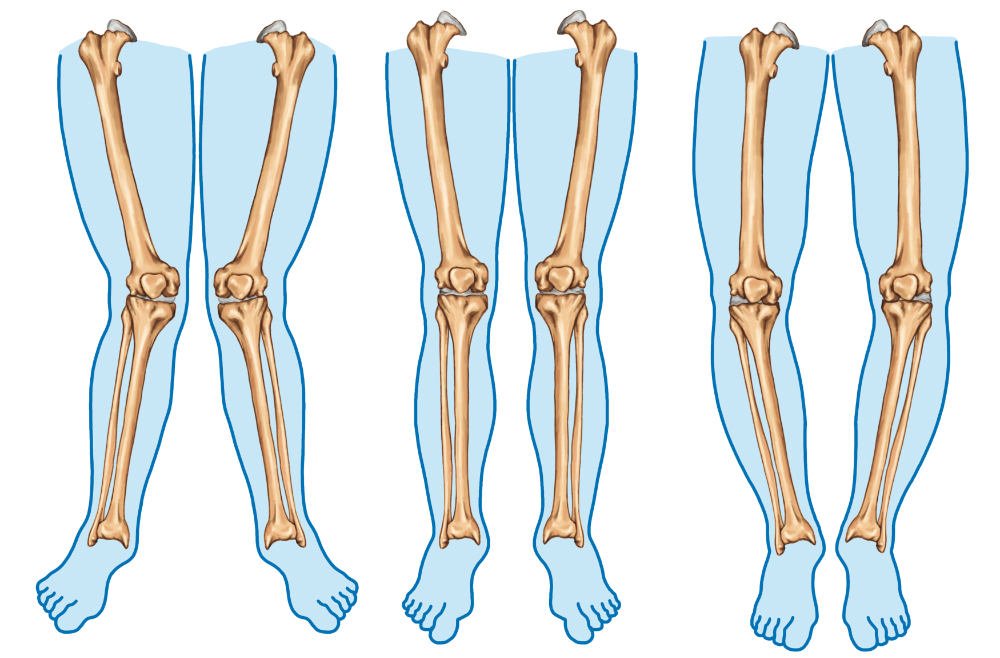 Important orthopedic terminology | CHAPTER 23 | Orthopedic Nursing