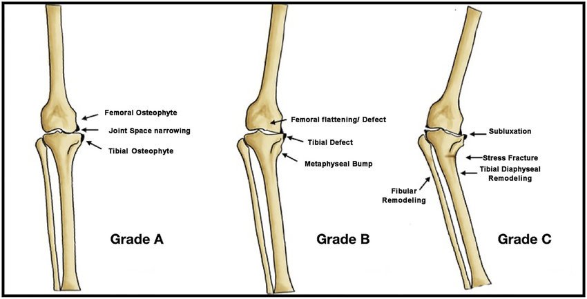 Important orthopedic terminology | CHAPTER 23 | Orthopedic Nursing