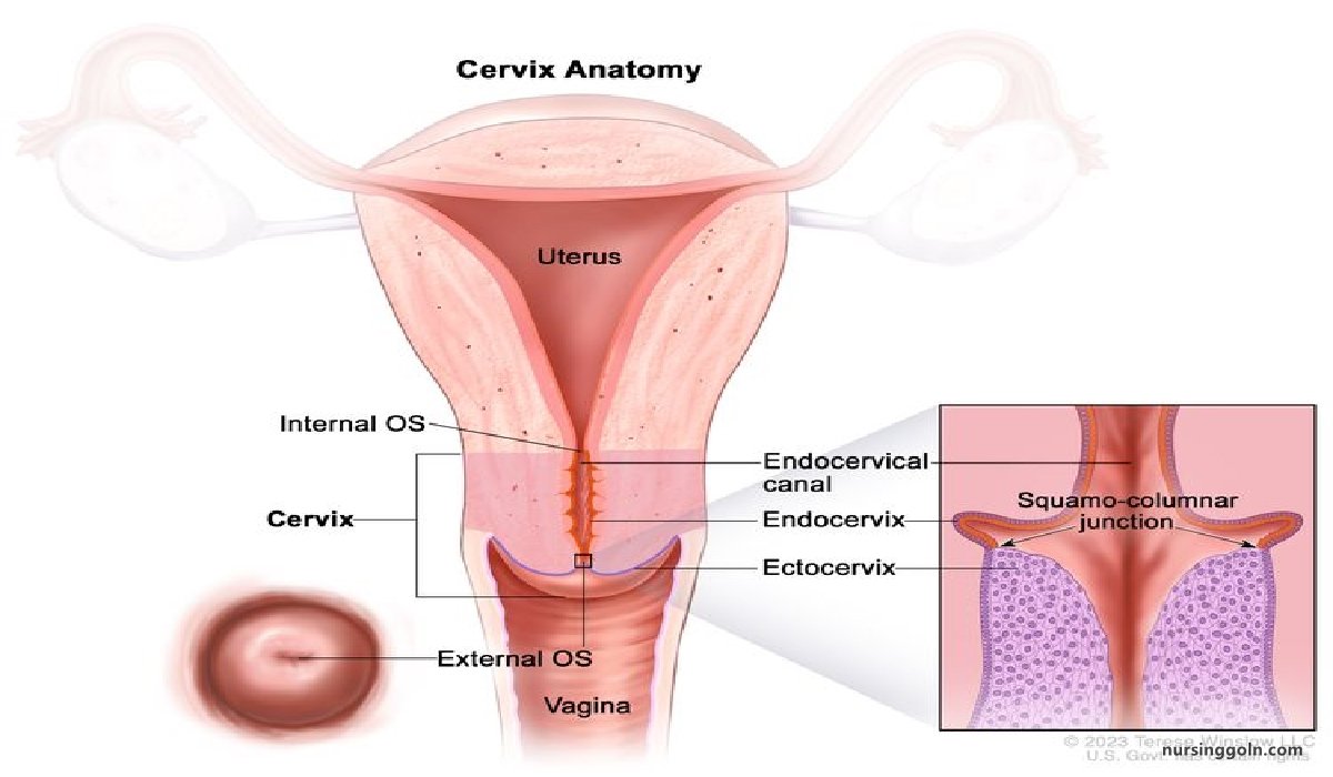 Cervical cancer | CHAPTER-12 | Medical and Surgical Nursing