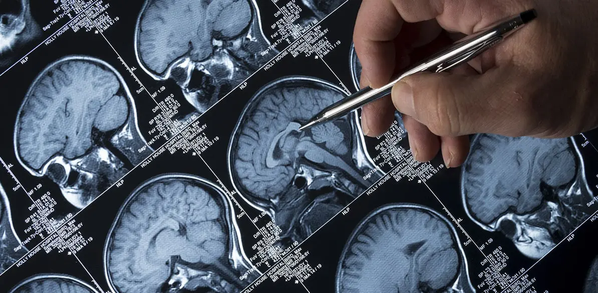 Convulsive disorder | CHAPTER 7 | Pediatric Nursing