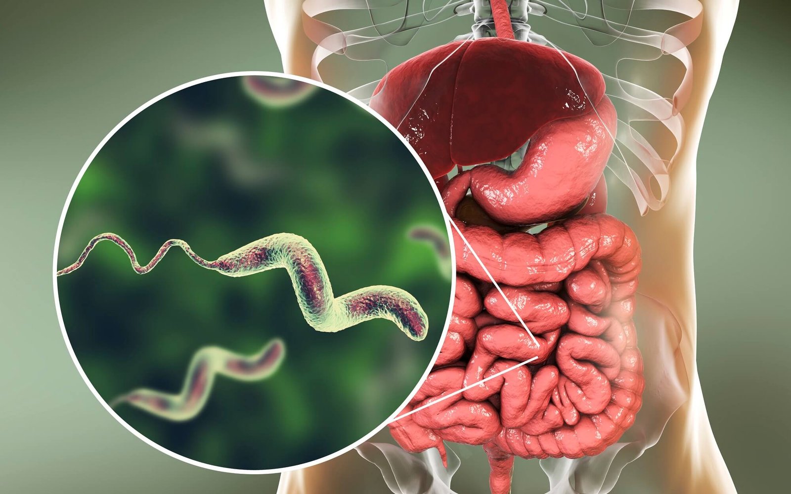 Diarrheal diseases | CHAPTER 6 | Pediatric Nursing