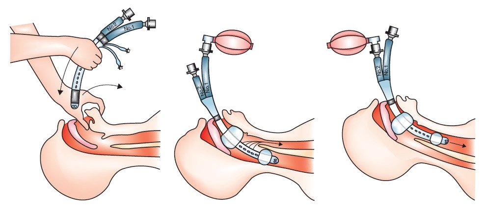 Introduction to Orthopedic Nursing