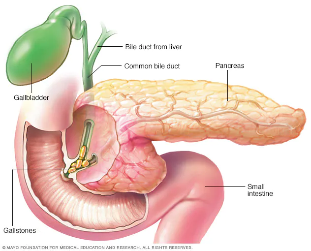 Definition of Pancreatitis | CHAPTER-6 | Medical and Surgical Nursing