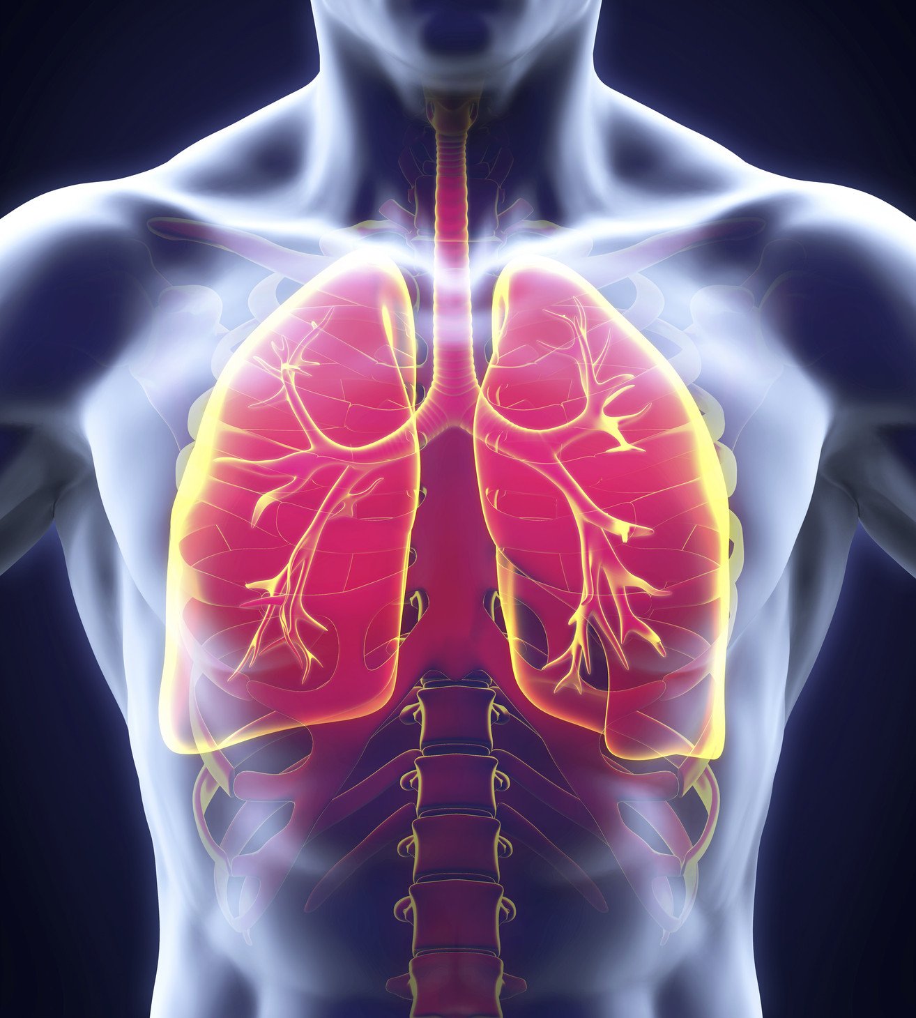 Concepts of Pneumonia | CHAPTER 6 | Pediatric Nursing