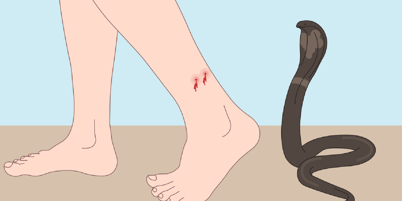 Snake bite | CHAPTER 21 | Fundamentals of Nursing