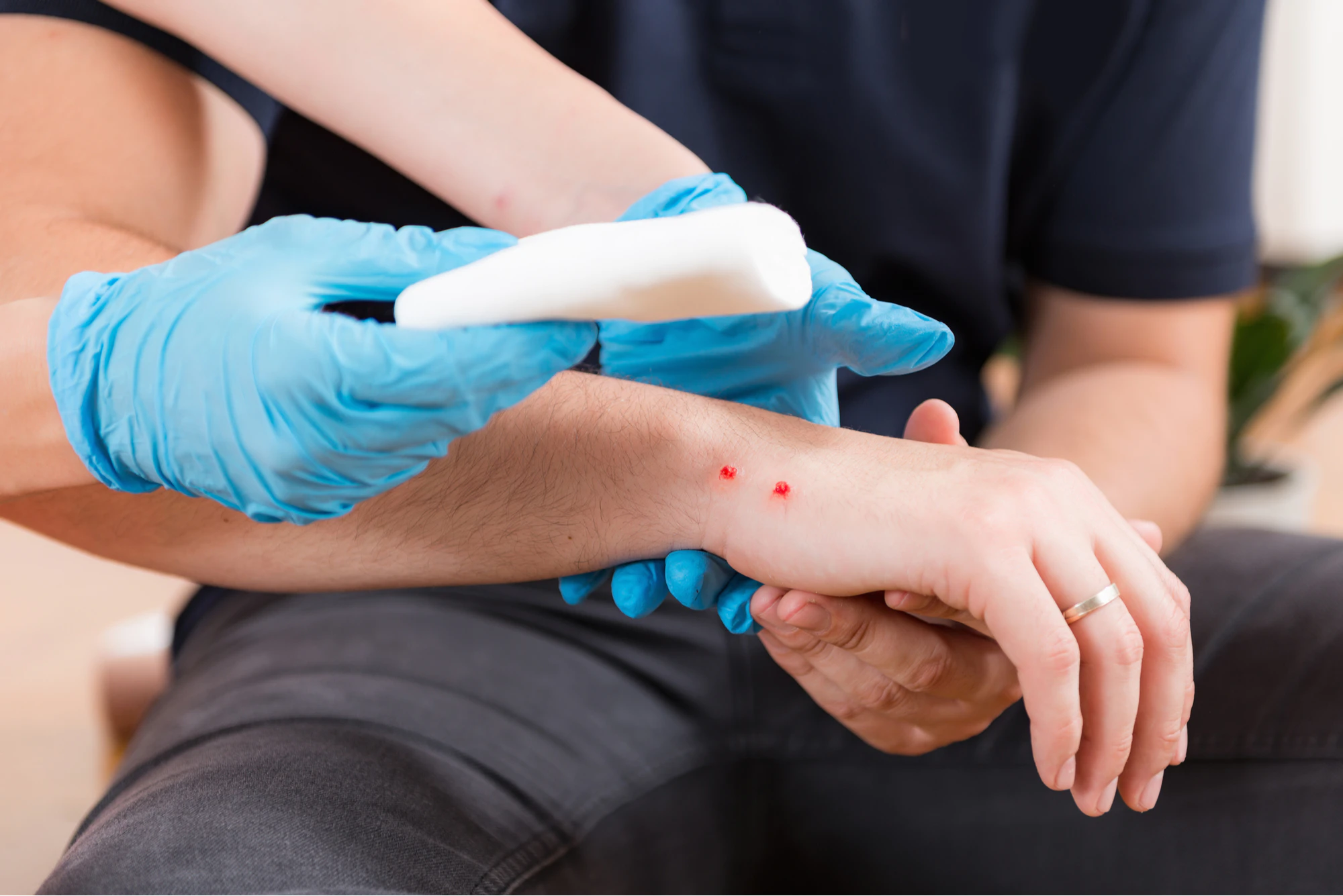 Snake bite | CHAPTER 21 | Fundamentals of Nursing