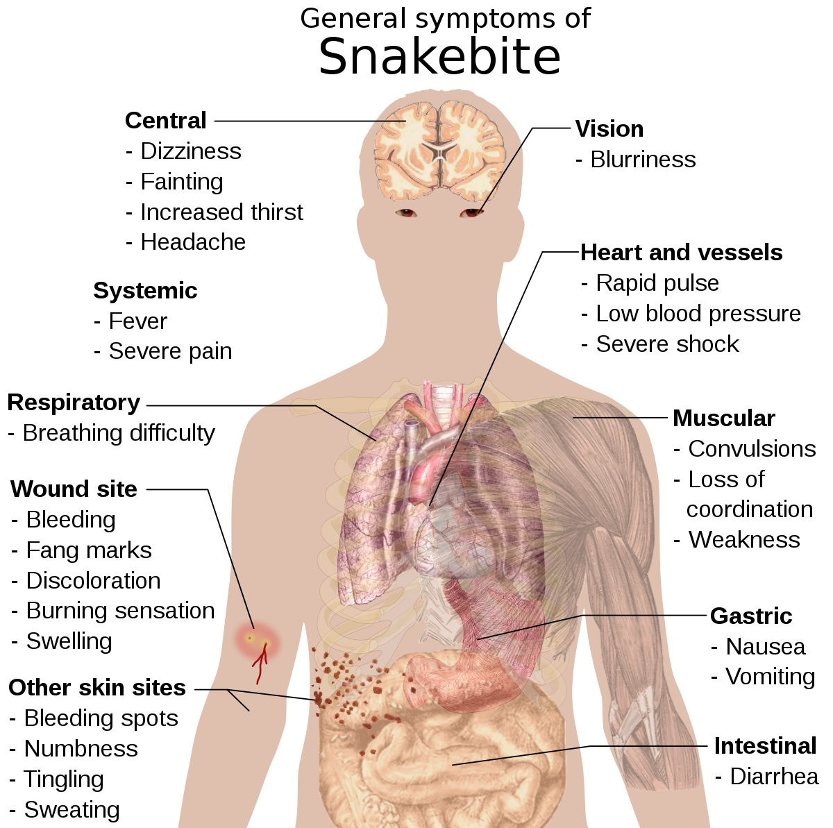 Snake bite | CHAPTER 21 | Fundamentals of Nursing