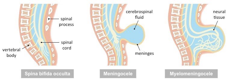 Chromosomal abnormalities | CHAPTER 8 | Pediatric Nursing