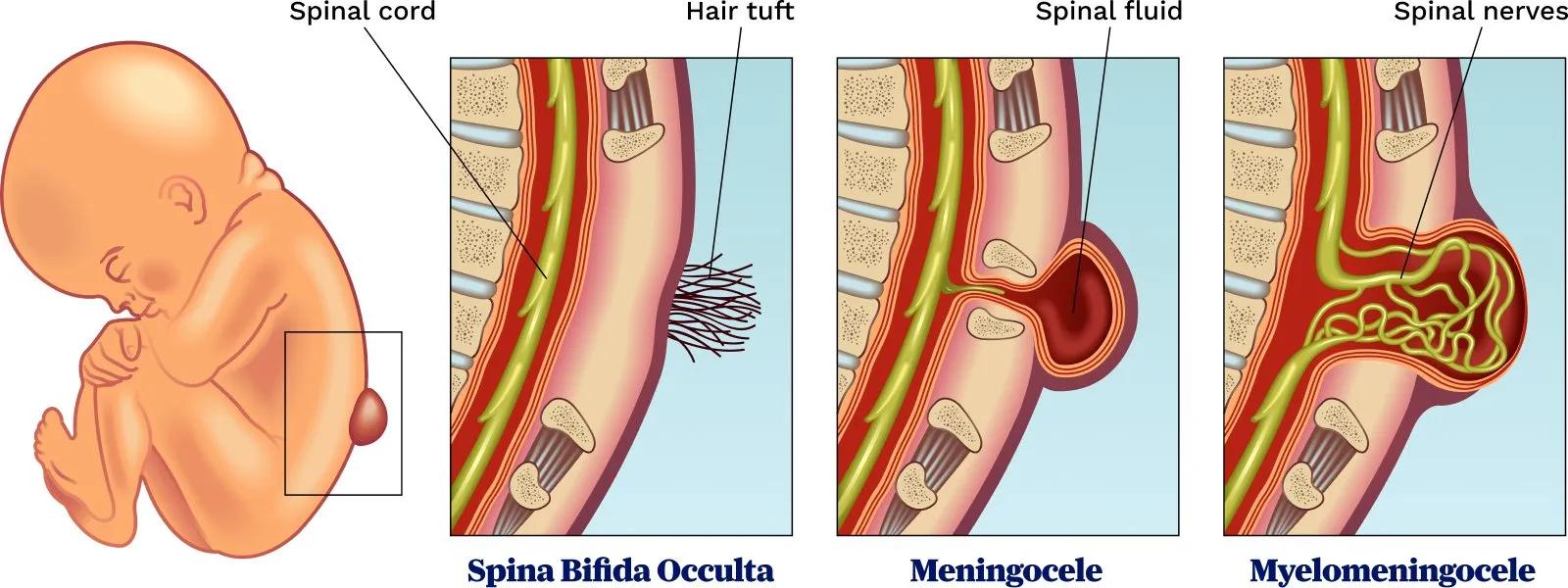 Chromosomal abnormalities | CHAPTER 8 | Pediatric Nursing