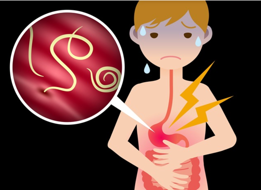 Worm infestation | CHAPTER 6 | Pediatric Nursing