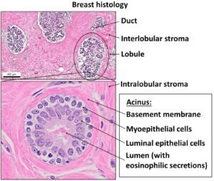 Normal histology of the breast, with luminal epithelial cells annotated near bottom right