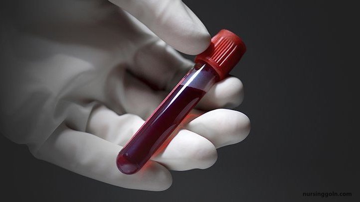 Hemostasis Blood vessel - The Cardiovascular System: Blood