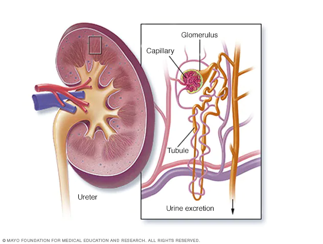 Acute Glomerulonephritis (AGN) | Chapter 7 | Medical And Surgical Nursing