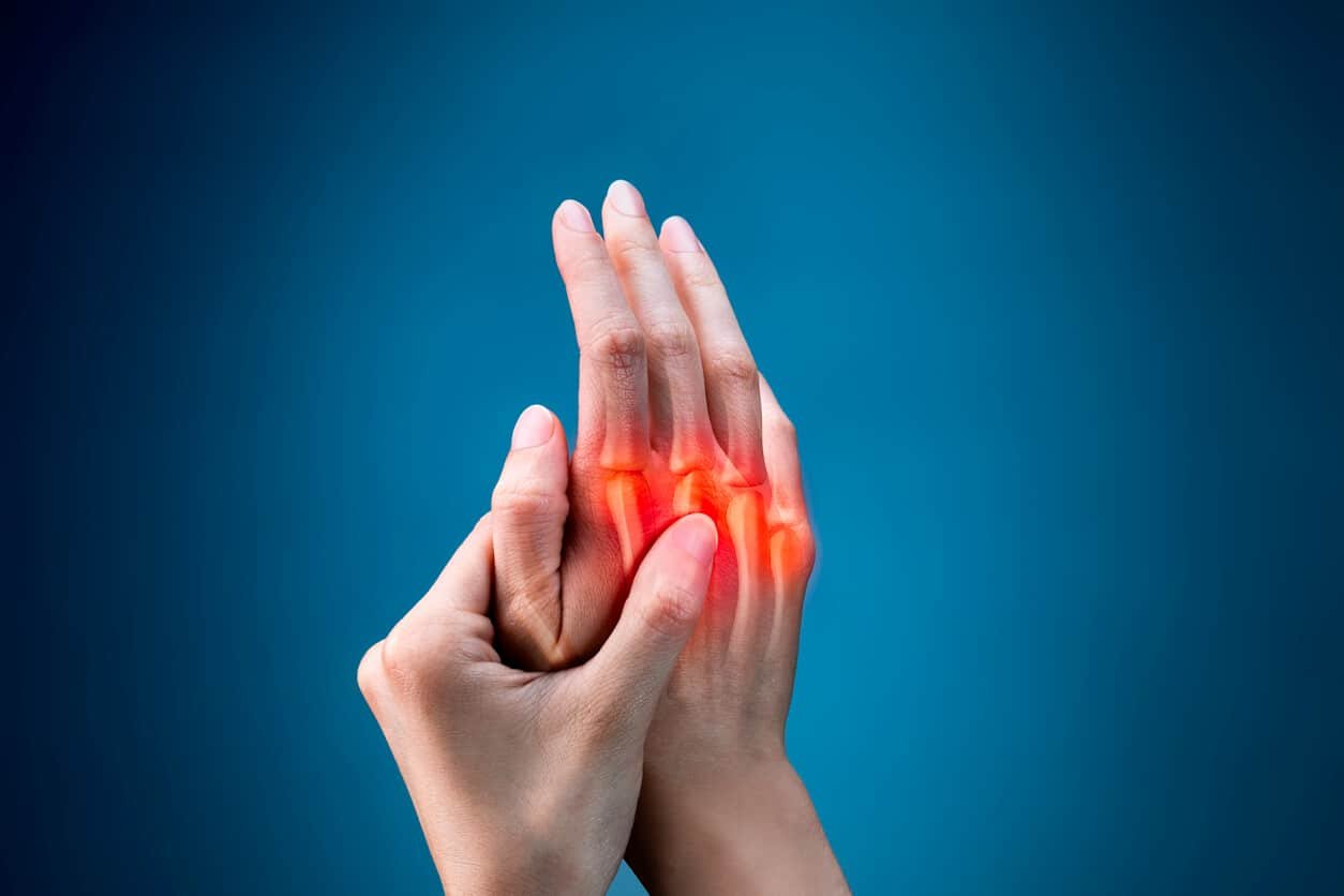 Rheumatoid Arthritis | CHAPTER 12 | Orthopedic Nursing