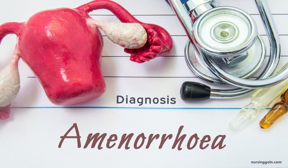 Concept of Amenorrhea | CHAPTER-17 | Medical and Surgical Nursing