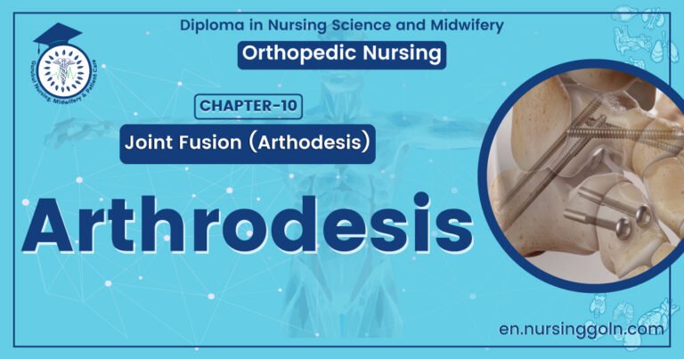 Definition of Arthrodesis | CHAPTER 10 | Orthopedic Nursing
