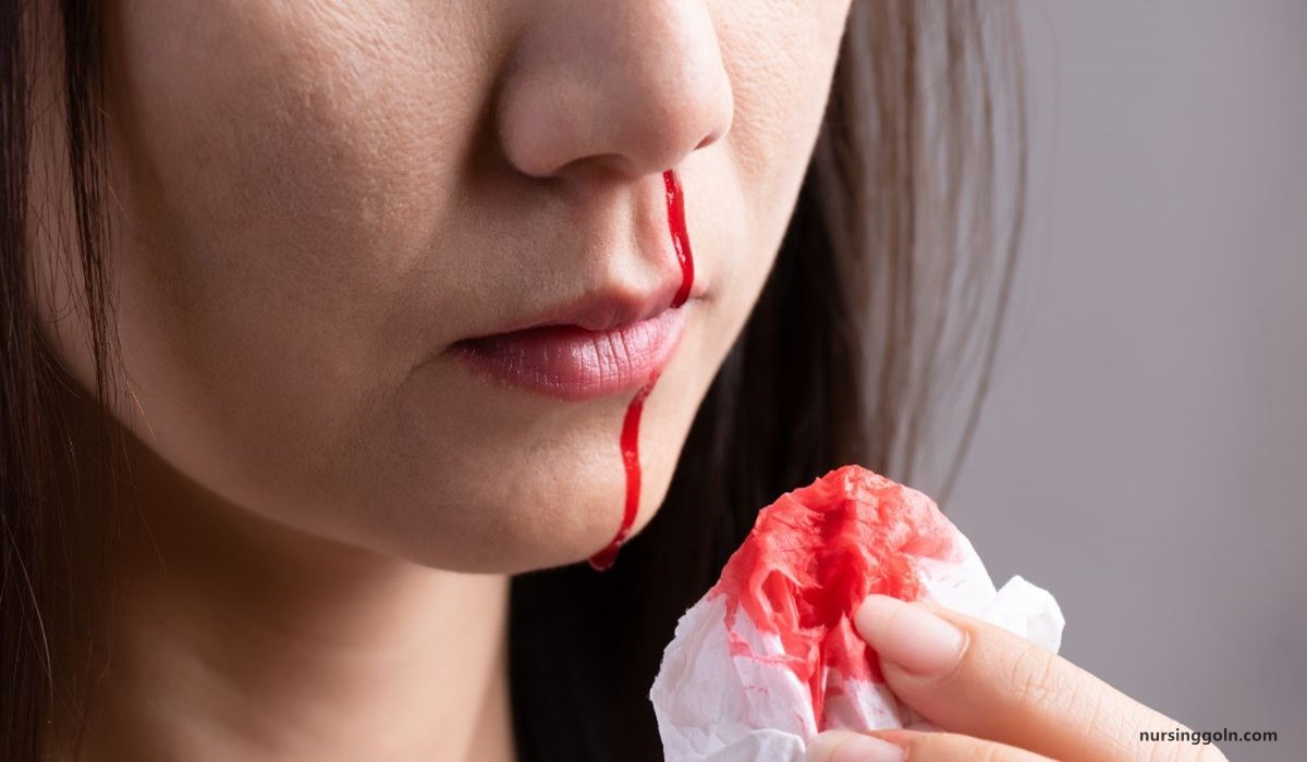 Haemorrhagic Disorder / Bleeding Disorder | CHAPTER-10 | Medical and Surgical Nursing