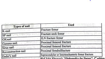 Definition Intramedullary (IM) Nail