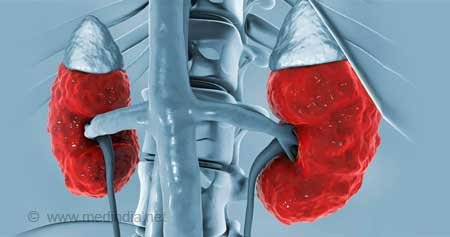 Chronic Renal Failure | Chapter 7 | Medical And Surgical Nursing