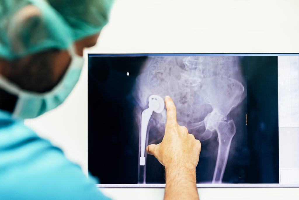 Common Orthopedic Surgery