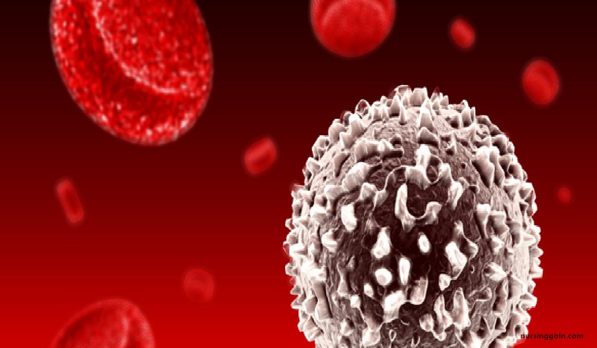 Concept of Leukemia | CHAPTER-10 | Medical and Surgical Nursing