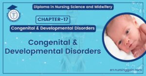 Congenital & Developmental Disorders | CHAPTER 17 | Orthopedic Nursing