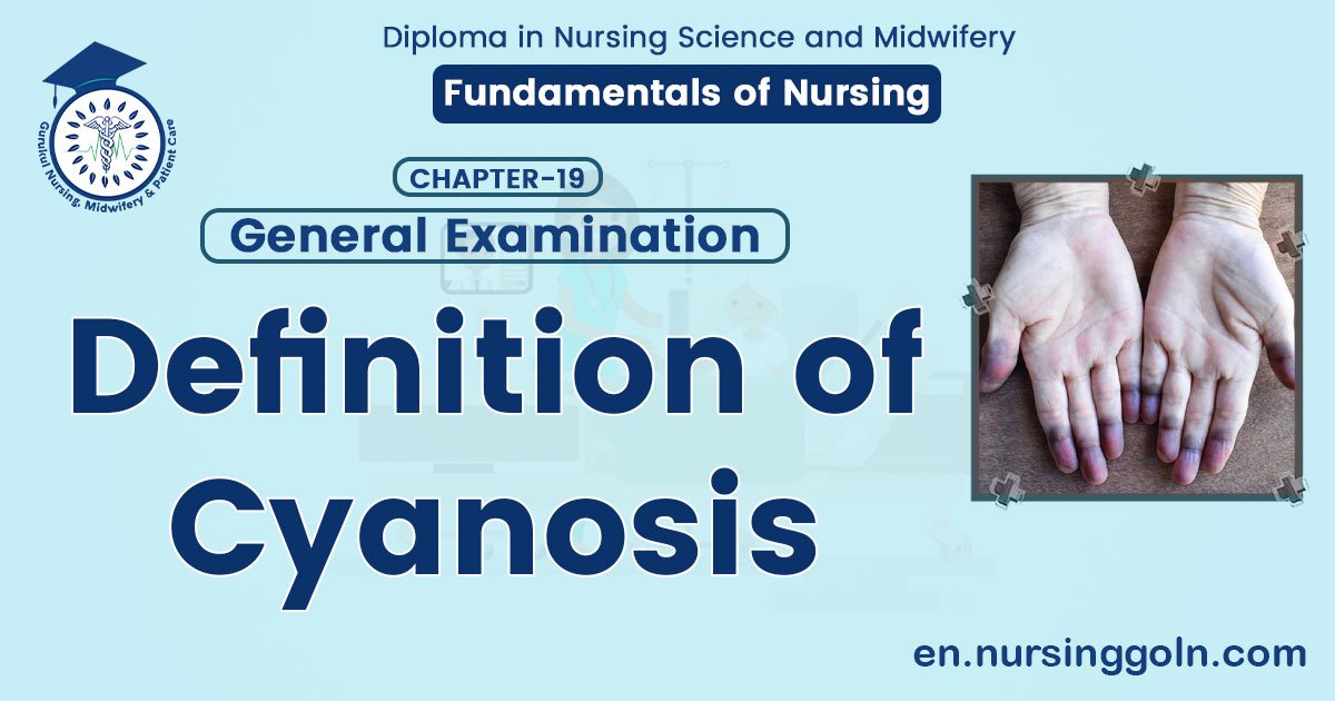 Definition of Cyanosis | CHAPTER-19: General Examination | Fundamentals of Nursing