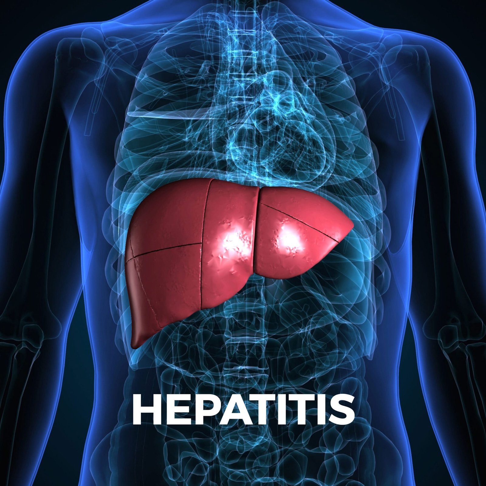 Concept about Hepatitis | CHAPTER 14 | Pediatric Nursing