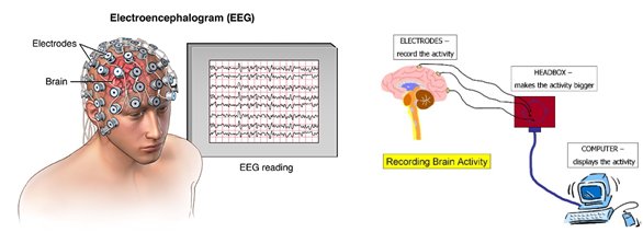 Concept about Electroencephalogram