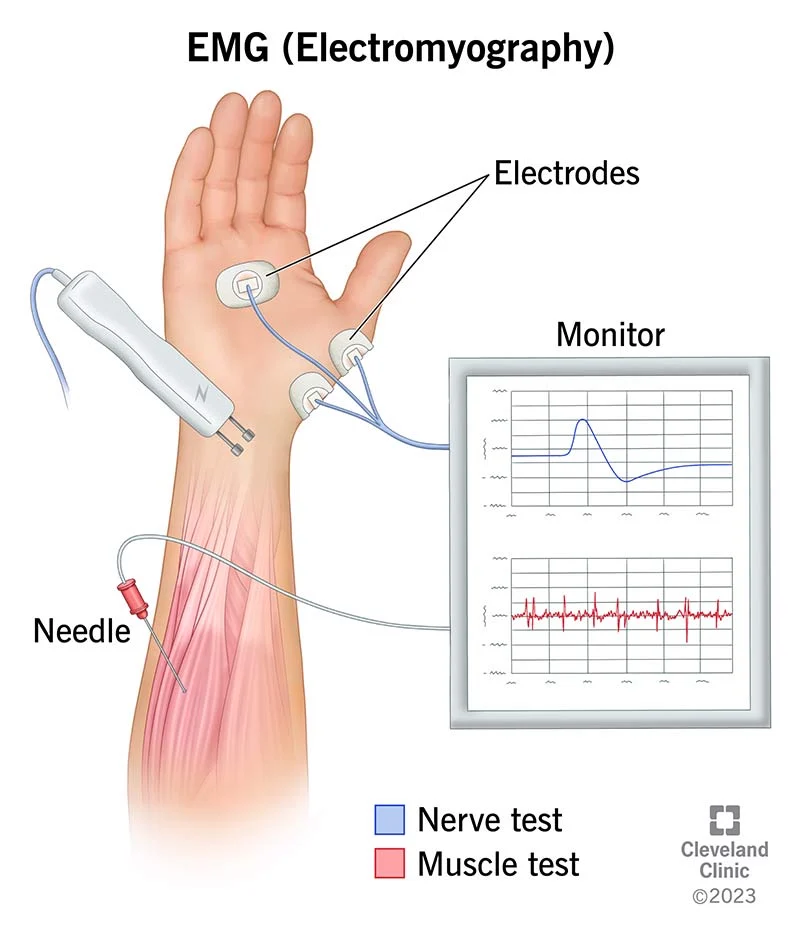 concept about electroencephalogram