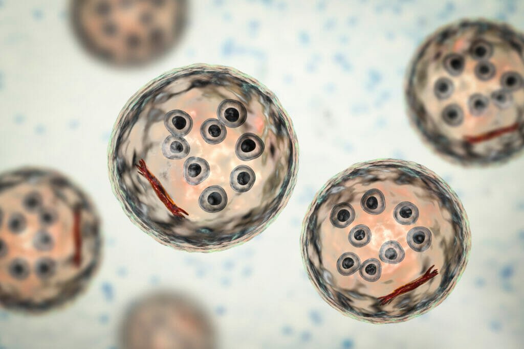 Entamoeba histolytica